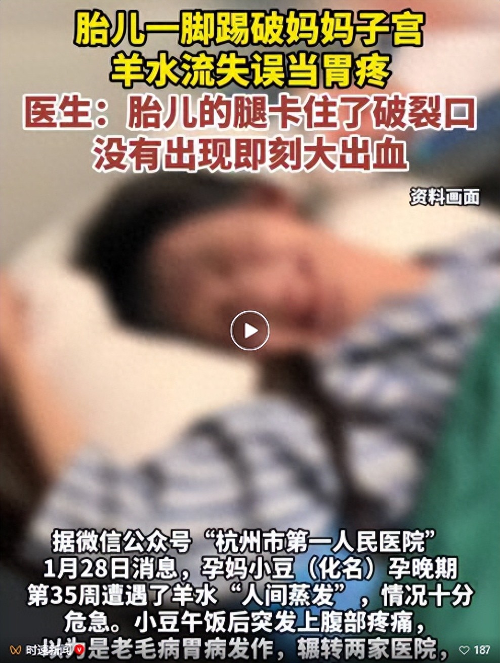 孕晚期胎儿踢的子宫痛__孕晚期胎宝宝踢的肚子疼